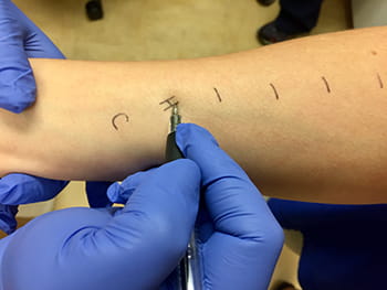 The nurses will mark the areas where the testing will be done