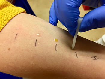 The plastic device is used to lightly scratch the top level of skin